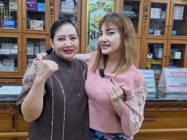 Hasil Operasi Hidung di Queen Klinik Sunter Bikin Irma Darmawangsa Puas
