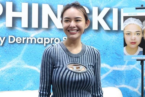 Amanda Manopo Bantah Operasi Plastik